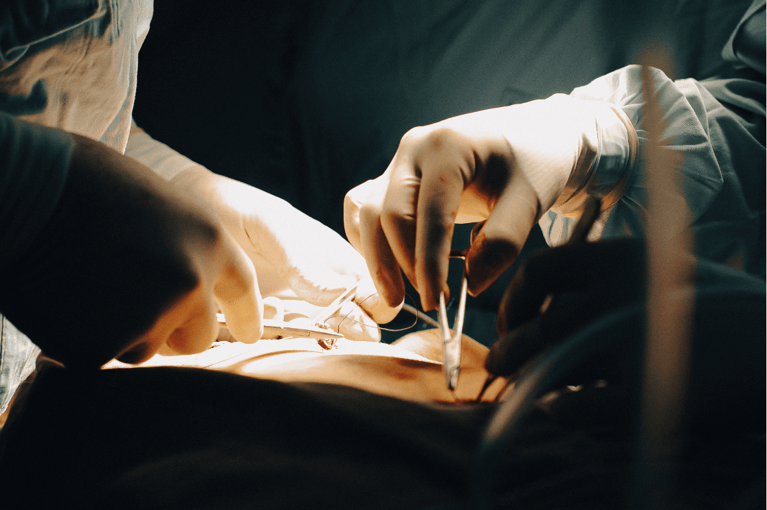 Cirugías de alta complejidad